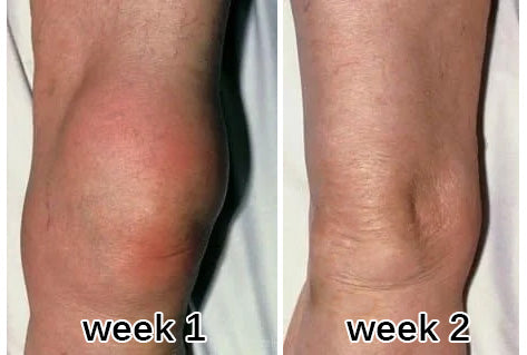 Customer knee review