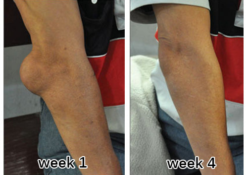 Customer elbow review
