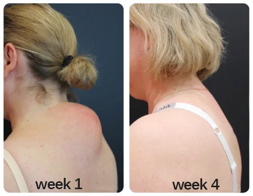 Customer neck comparison