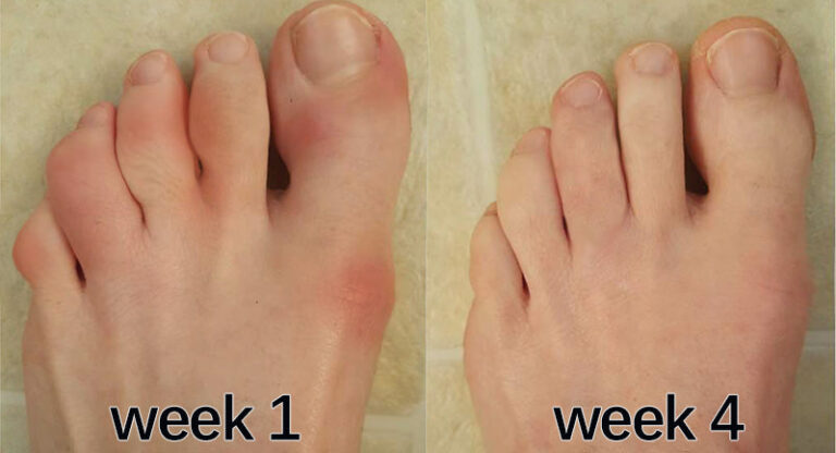 Customer foot comparison